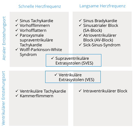 Eine Tabelle mit häufige Arrhythmien