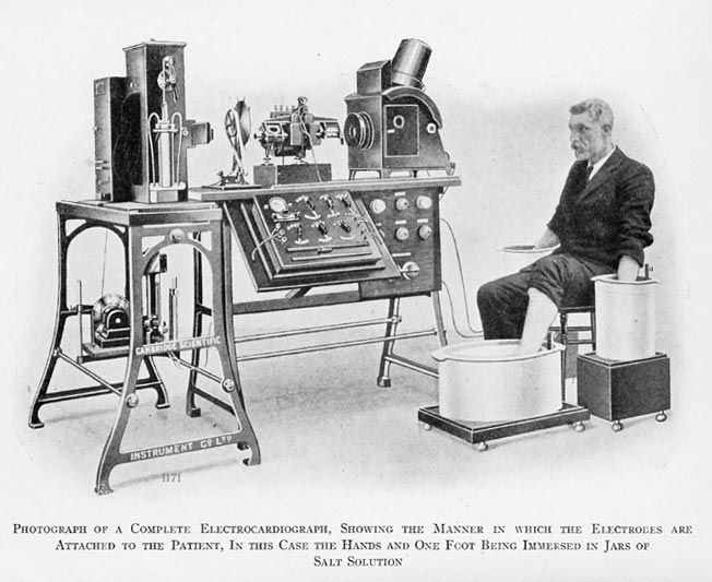 Photograph of the first cardiograph developed by Einthoven at the beginning of the 20th century